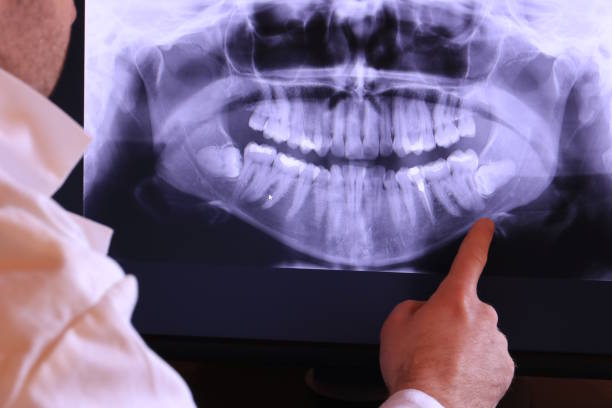 Best Broken Tooth Emergency  in Hull, IA